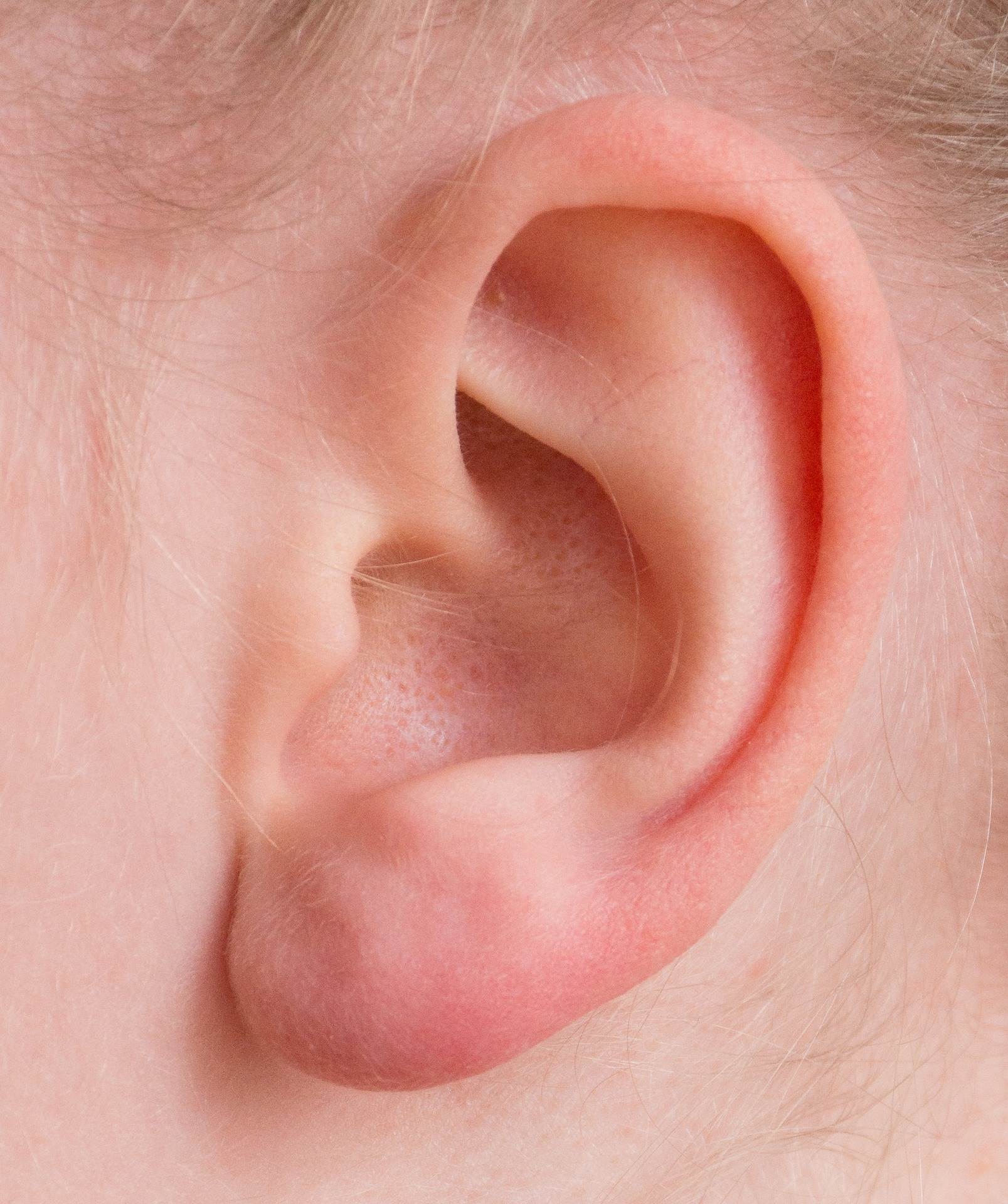 Auricular Acupuncture…With or Without Needles